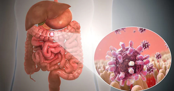 acute-gastroenteritis